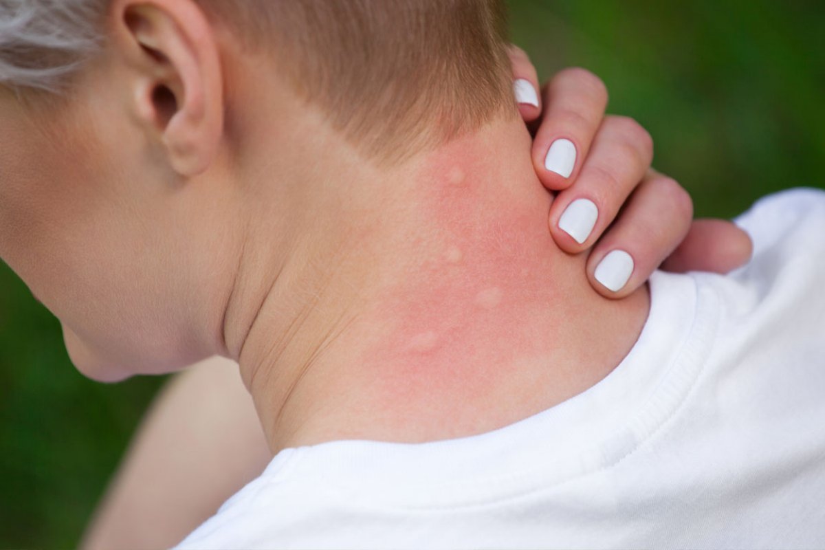 Family enjoying a mosquito-free backyard patio in the Greater Binghamton NY area after professional mosquito control treatment from A Great Choice Lawn Care